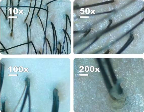 Some Title Some Alt Text