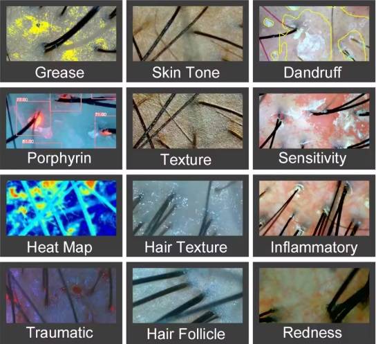 Some Title Some Alt Text