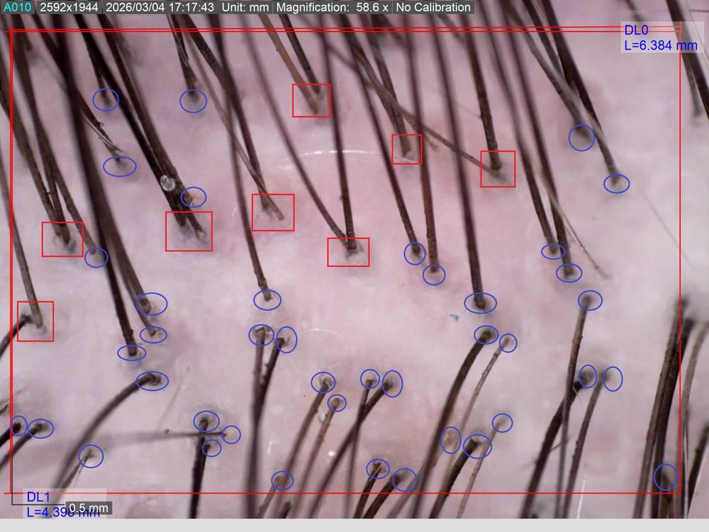 Some Title Some Alt Text