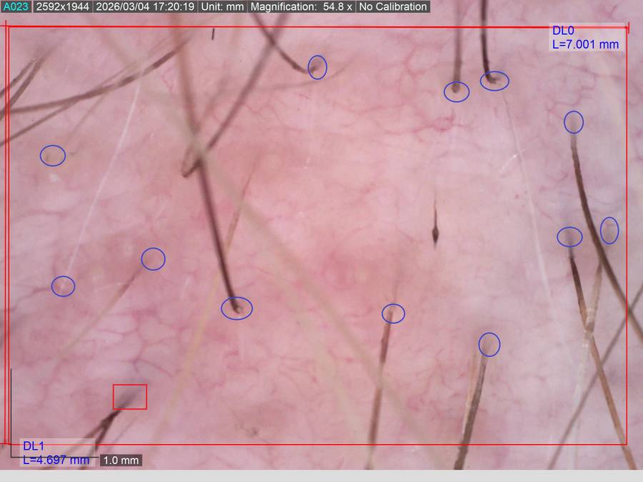 Some Title Some Alt Text