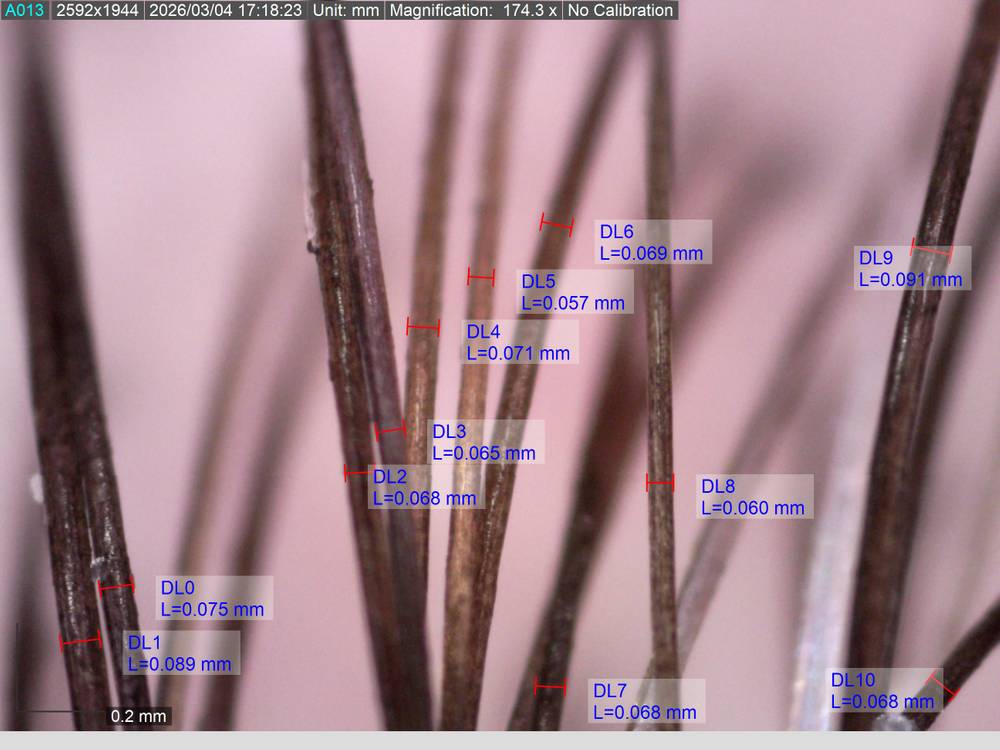 Some Title Some Alt Text