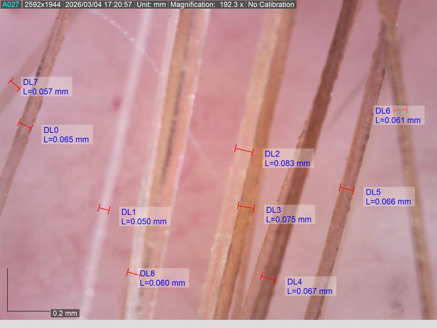 Some Title Some Alt Text