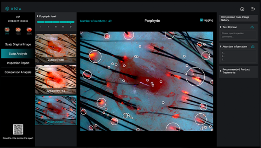 Some Title Some Alt Text